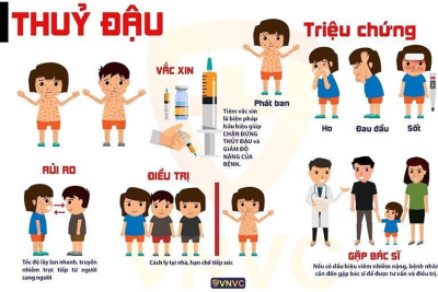 BÀI TUYÊN TRUYỀN VỀ BỆNH THUỶ ĐẬU