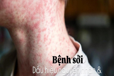 BÀI TUYÊN TRUYỀN PHÒNG CHỐNG BỆNH SỞI TRƯỜNG TIỂU HỌC THỊ TRẤN QUỸ NHẤT